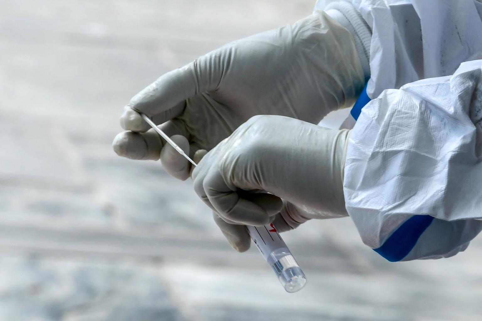 Kes COVID-19 Dijangka Melonjak Dalam Masa 3 Bulan!