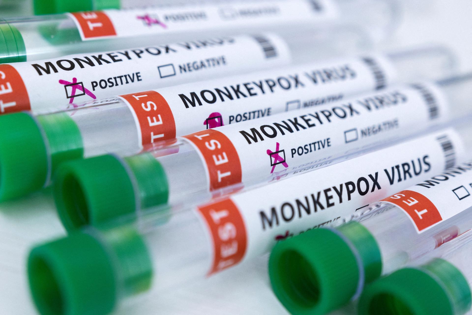 Monkeypox Cetus Panik, CDC AS Aktifkan Pusat Operasi Kecemasan!