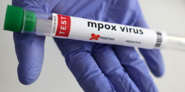 Thailand Sahkan Kes Asia Pertama Mpox! Malaysia Dalam Risiko?