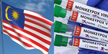 1 Kes Mpox Terbaru Dikesan Di Malaysia!