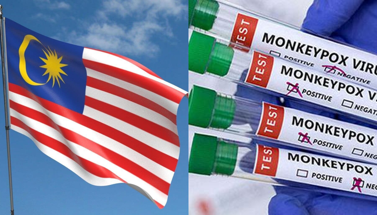 1 Kes Mpox Terbaru Dikesan Di Malaysia!